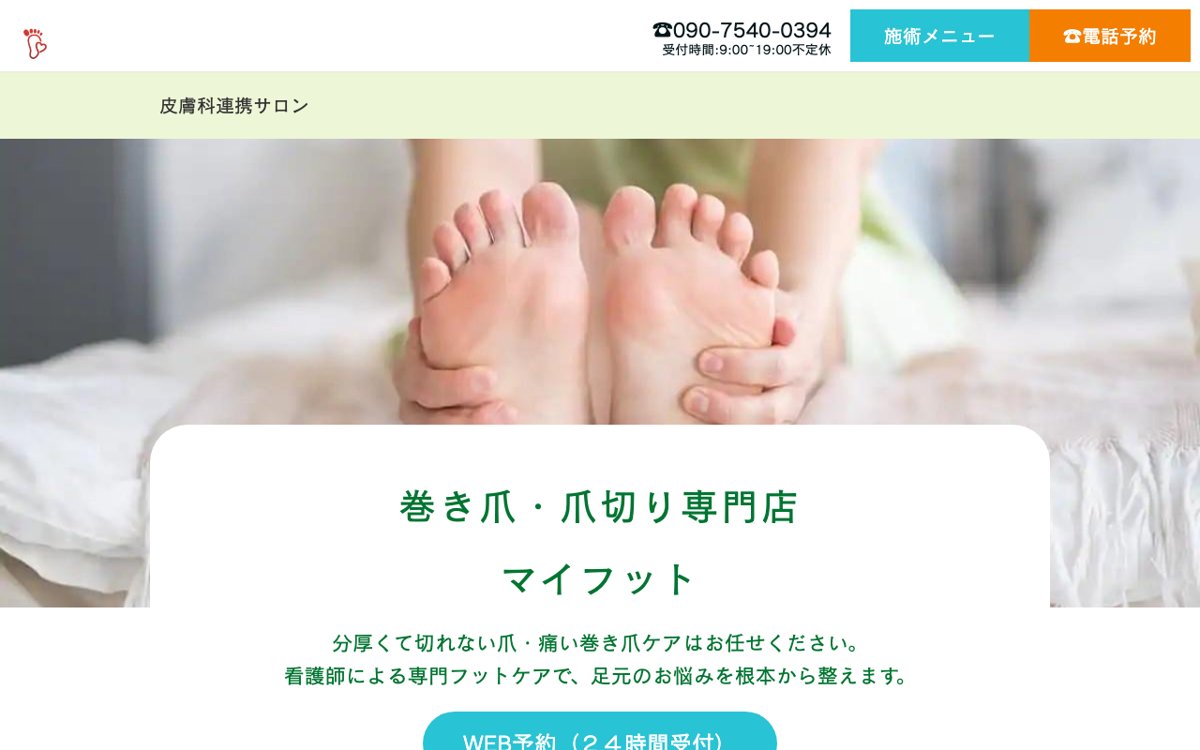 大阪北摂で巻き爪や厚い爪のケアを頼むなら|巻き爪・爪切り専門店マイフット 公式サイト